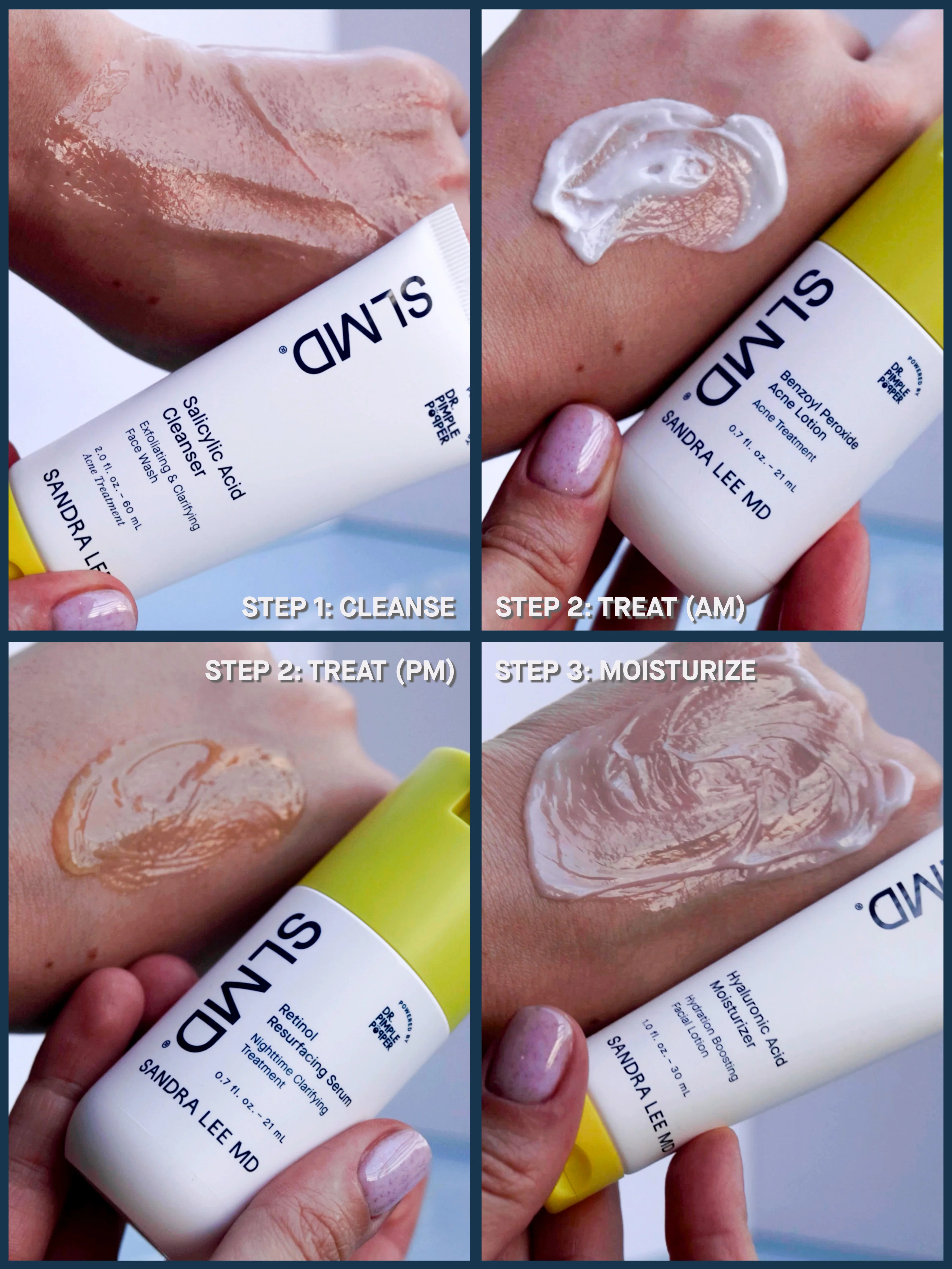 Acne System - Image 3