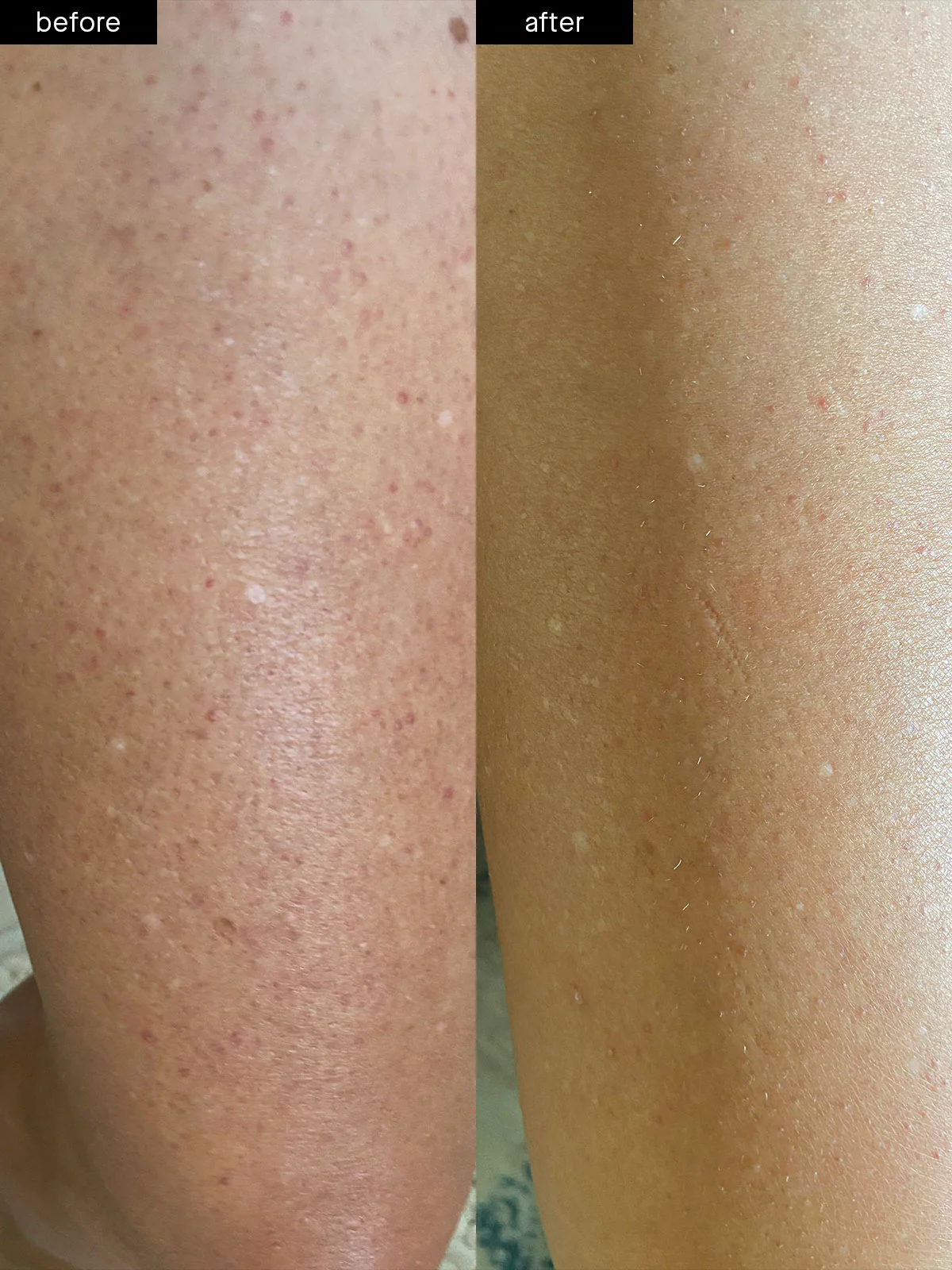 Body Smoothing System - Image 4