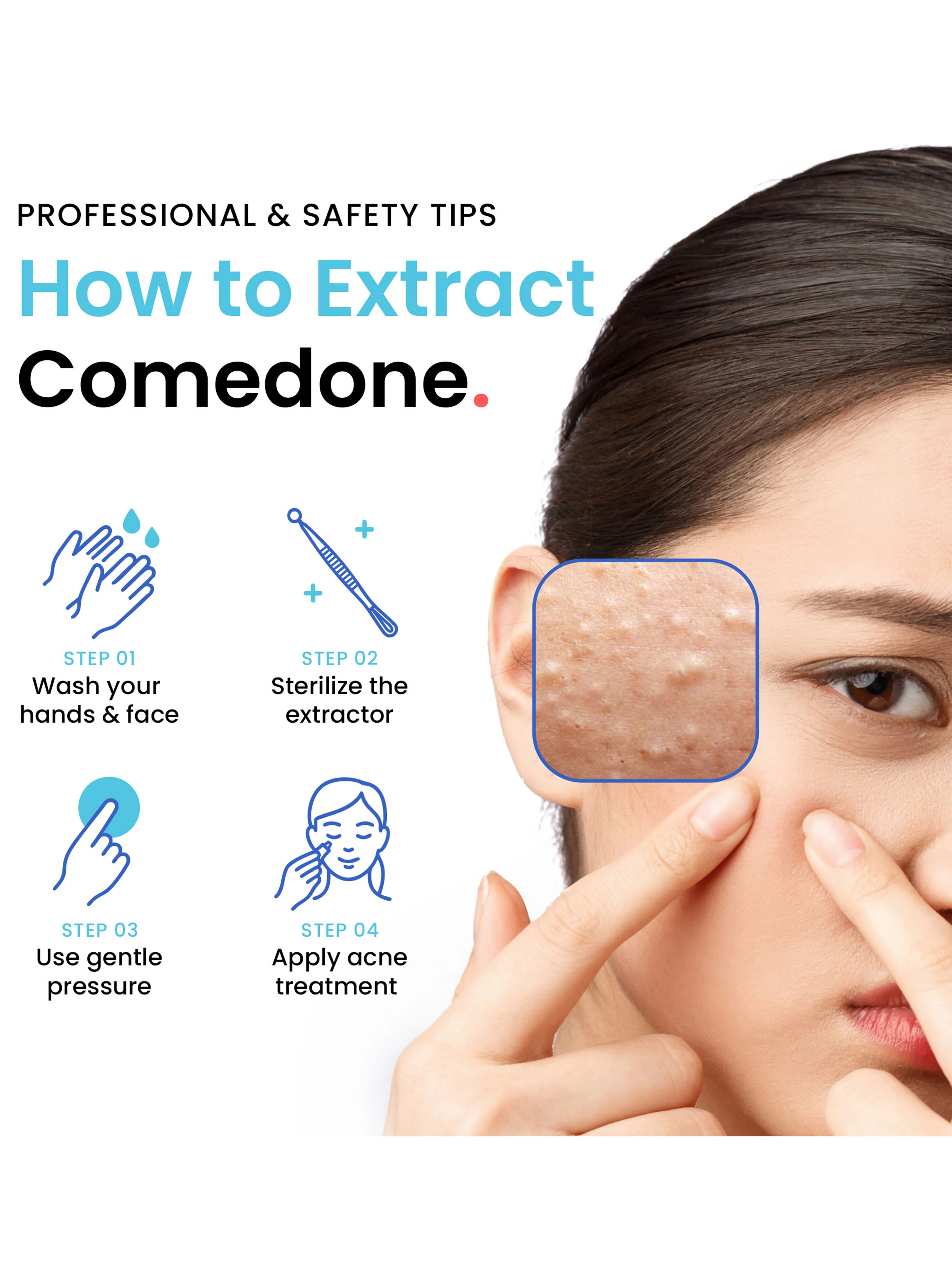 Comedone Extractor - Image 4