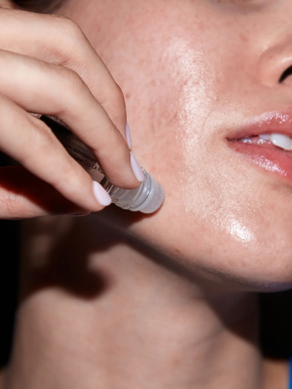 SA Acne Spot Treatment - Image 3