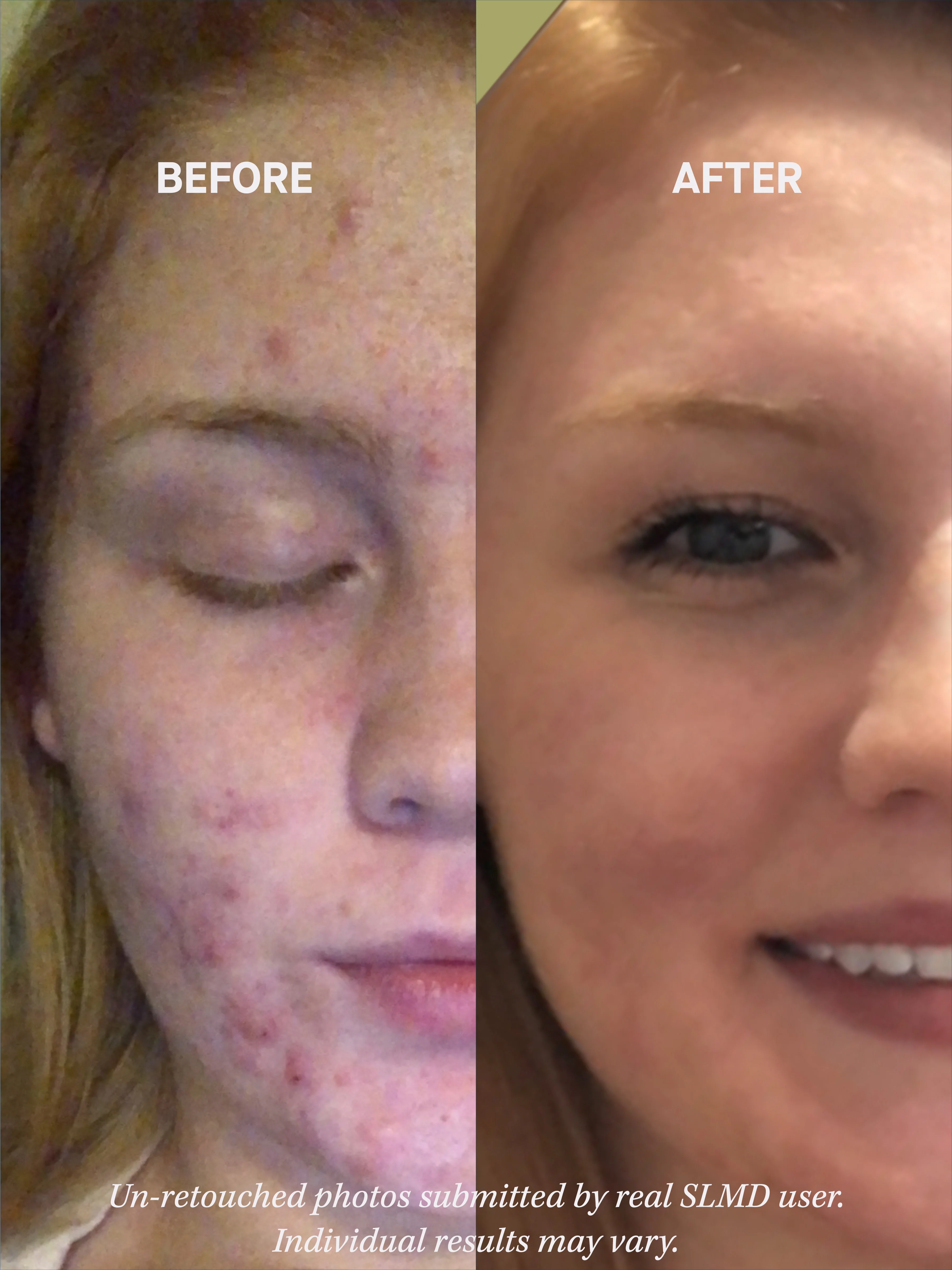 Salicylic Acid Cleanser - Image 5